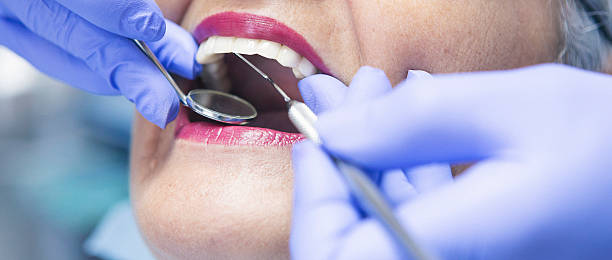 Best Emergency Root Canal Therapy in Rosedale, MD